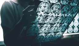 Nếu không phân biệt được 5 mùi này, bạn có nguy cơ mất trí nhớ