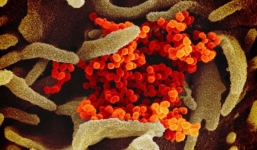 Vừa hết dịch Covid-19, Iran lại có thêm 3 ca nhiễm mới