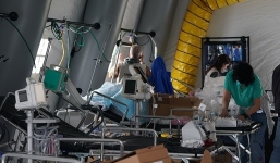 Covid-19 có thể gây tổn thương não nghiêm trọng