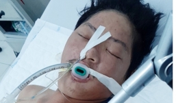 Tìm người thân thanh niên chết não ở Phú Quốc