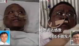 Bác sĩ nhiễm Covid-19 tại Vũ Hán đổi màu da sau khi điều trị