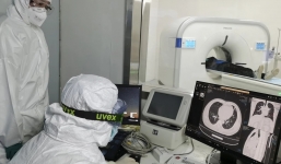 Covid-19 có thể 'trốn' sâu trong phổi, không dễ bị phát hiện