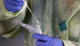 Covid-19 lây lan nhanh chóng khắp thế giới từ cuối năm ngoái