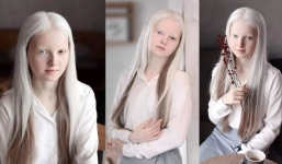 Vẻ đẹp lạ lùng của cô gái có mái tóc trắng tinh, mắt 2 màu