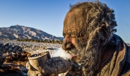 Người đàn ông không tắm rửa hơn 60 năm, cách ăn uống mới đáng sợ