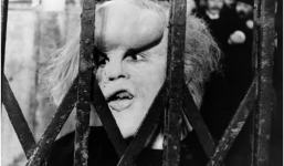 Xót xa 'Người Voi' sống cả đời trong sự ghẻ lạnh, tàn nhẫn của cộng đồng