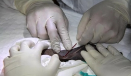 Đã xác định được nguồn gốc của SARS-CoV-2 gây Covid-19 