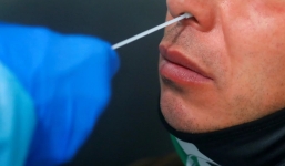 Tìm ra lý do khiến bệnh nhân Covid-19 bị mất cảm giác mùi, vị