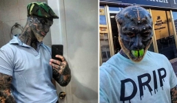 Chàng trai biến mình thành người ngoài hành tinh sau vô vàn đau đớn