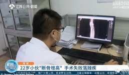 Phẫu thuật kéo dài chân mong cao 1,8m, thanh niên hối hận không kịp