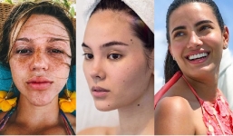 15 nữ hoàng sắc đẹp 'thả rông nhan sắc', lộ cả tàn nhang, nốt ruồi nhưng vẫn thần thái ngút trời