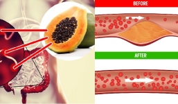 7 tác dụng kỳ diệu khi ăn đu đủ mỗi tuần một lần