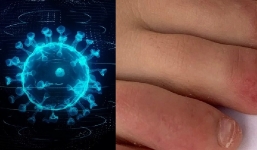 10 dấu hiệu lạ của Covid-19 có thể bạn chưa biết