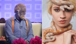 12 căn bệnh lạ nhất thế giới đến giờ y học vẫn 'bó tay'