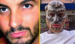 Gặp biến chứng khi làm người ngoài hành tinh, chàng trai vẫn không từ bỏ đam mê