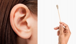 Ráy tai đổi màu tiết lộ tình trạng sức khỏe của bạn