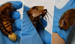 Nga: Phẫu thuật cứu sống gián mẹ bị biến chứng thai kỳ