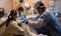 Biến thể Covid-19 tại Mỹ lây lan nhanh và rất nguy hiểm