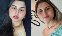 Cặp song sinh đầu tiên trên thế giới sung sướng khi cùng chuyển giới