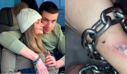 Xích tay với bạn trai để thể hiện tình yêu, cô gái khóc thét vì kết cục nhận được