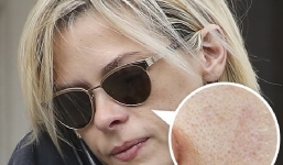 Những thói quen khiến 7749 bước skincare của bạn đều 'đổ sông đổ biển'