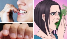 Cắn móng tay: Thói quen gây combo hậu quả xấu xí, hôi hám, bệnh tật