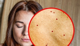 Môi mỏng, bọng mắt và loạt dấu hiệu cảnh báo mặt bạn đang lão hóa sớm