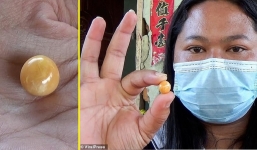 Đổi đời nhờ tìm thấy ngọc trai quý bên trong bữa ốc giá 50.000 đồng