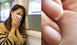 Cả ngày uể oải và 9 dấu hiệu cảnh báo cơ thể đang thiếu một vi chất cực kỳ quan trọng