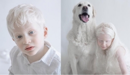 Đắm chìm trước vẻ đẹp lạ của những người bạch tạng