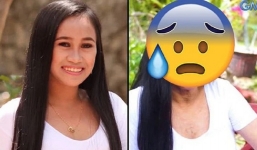 Thiếu nữ 16 xinh như mộng bỗng hóa bà lão U60 chỉ sau một lần phát ban