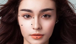 5 nốt ruồi xấu nhất cho hôn nhân tình duyên, là khắc tinh của các cặp đôi