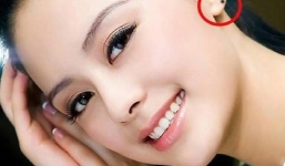 4 nốt ruồi hiếm và quý hơn vàng, tuyệt đối không được xóa