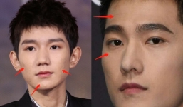 Soi khuyết điểm mỹ nam Cbiz: Dương Dương lộ nếp nhăn, Vương Nguyên mặt chi chít mụn, Nhất Bác da đẹp xỉu
