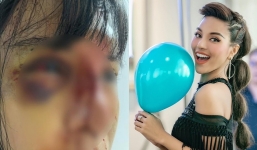 Thông tin chi tiết về siêu mẫu Khả Trang, mất tích bí ẩn trở về 'thân xác hoang tàn' chấn động MXH, tình trạng hiện tại