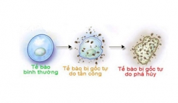 Khối u bướu hình thành qua những bước nào?