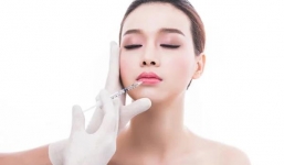 Tiêm filler môi giữ được bao lâu? Chi phí ra sao?