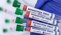 Có nên tiêm vaccine đậu mùa khỉ?