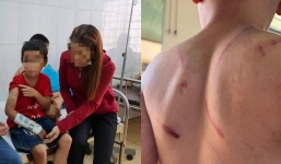 Đắk Lắk: Nghi vấn bà nội dùng búa đóng đinh ‘tra tấn’ bé 9 tuổi, lấy mì tôm sống ăn cho đỡ đói cũng bị đòn