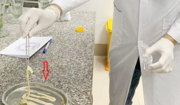 Bác sĩ lấy con sán gần 1 mét trong bụng bé 2 tuổi, khuyến cáo sai lầm cực tai hại của nhiều phụ huynh 