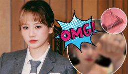 Hari Won bị liệt nửa mặt: Chuyên gia chỉ ra sai lầm giới trẻ thường mắc gây ra bệnh, phòng tránh thế nào?