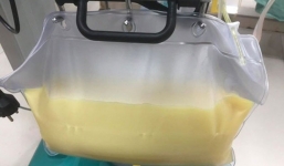 Người đàn ông có huyết tương trắng đục như sữa vì nghiện thức uống này