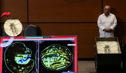 Bằng chứng mới về 'người ngoài hành tinh': Hóa thạch 1000 năm tuổi tại Peru giải mã bí ẩn vũ trụ