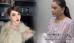 Lâm Khánh Chi kể tường tận công cuộc ‘trùng tu’ gương mặt, dân tình vừa thương vừa sợ