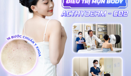 Acthyderm - CO2: Công nghệ trị mụn chuẩn y khoa giúp da khỏe đẹp từ bên trong