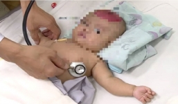 Hy hữu: Bé gái 2 tháng tuổi bị chấn thương sọ não vì bố làm rơi điện thoại trúng đầu.