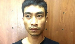 Nữ hộ sinh bị người đàn ông đánh lệch sống mũi, vỡ hốc mắt chỉ vì va chạm nhỏ