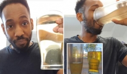 Người đàn ông uống chính nước tiểu của mình suốt 3 năm để cảm thấy hạnh phúc và thông minh hơn