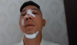 Lương Bằng Quang gây sốc khi quyết định phẫu thuật thẩm mỹ thay đổi 100% khuôn mặt ở tuổi 37