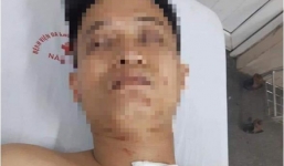 Tin tức pháp luật 24h nóng nhất, mới nhất hôm nay ngày 1/4/2019